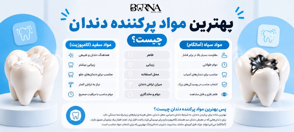 پرکردن دندان با مواد سفید بهتر است یا سیاه؟